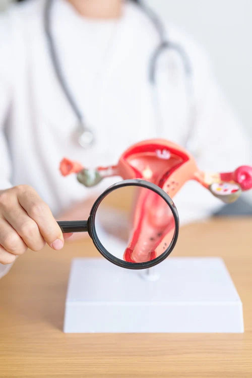 Torbiel na jajniku – co powinnaś o niej wiedzieć?